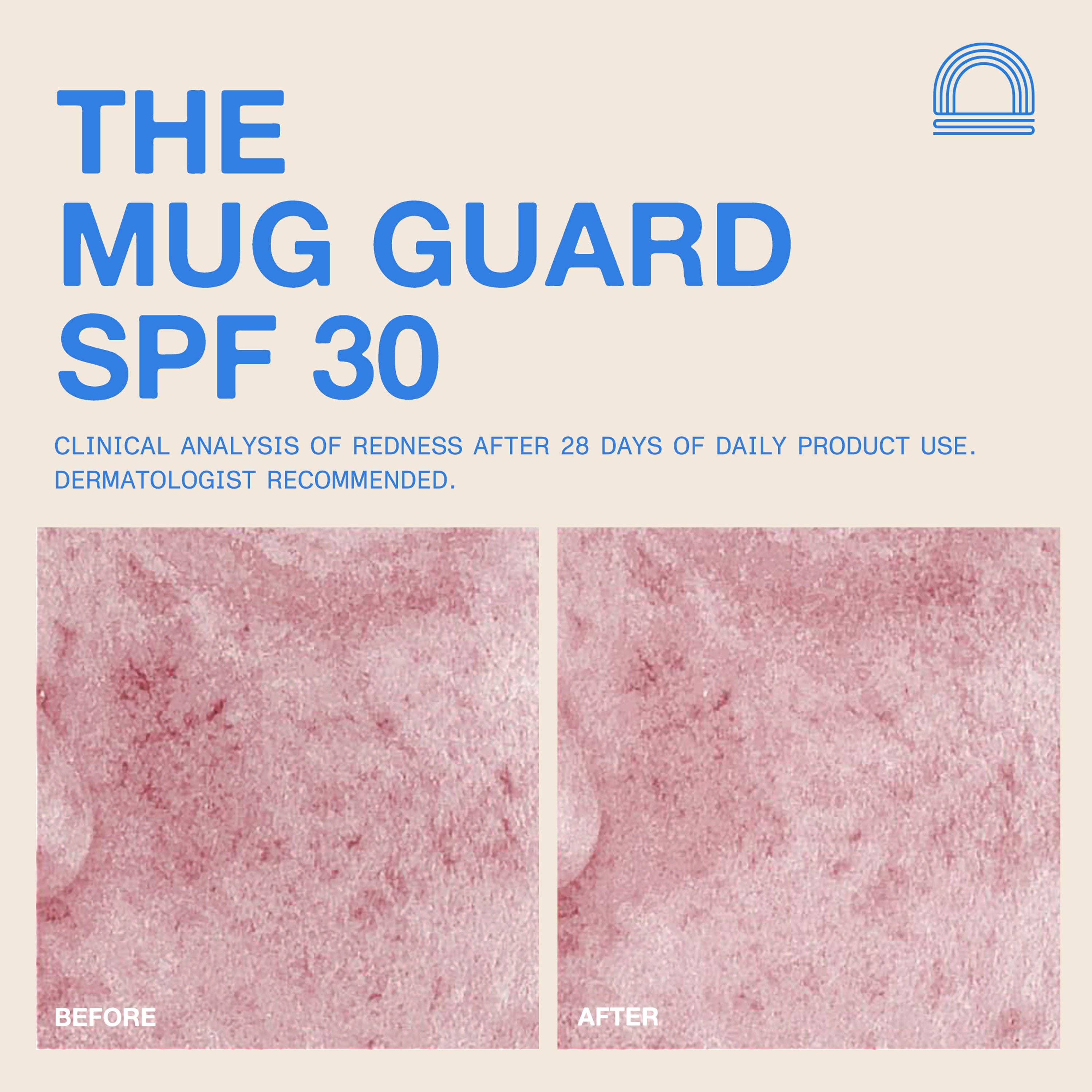 DUNE Suncare- The Mug Guard