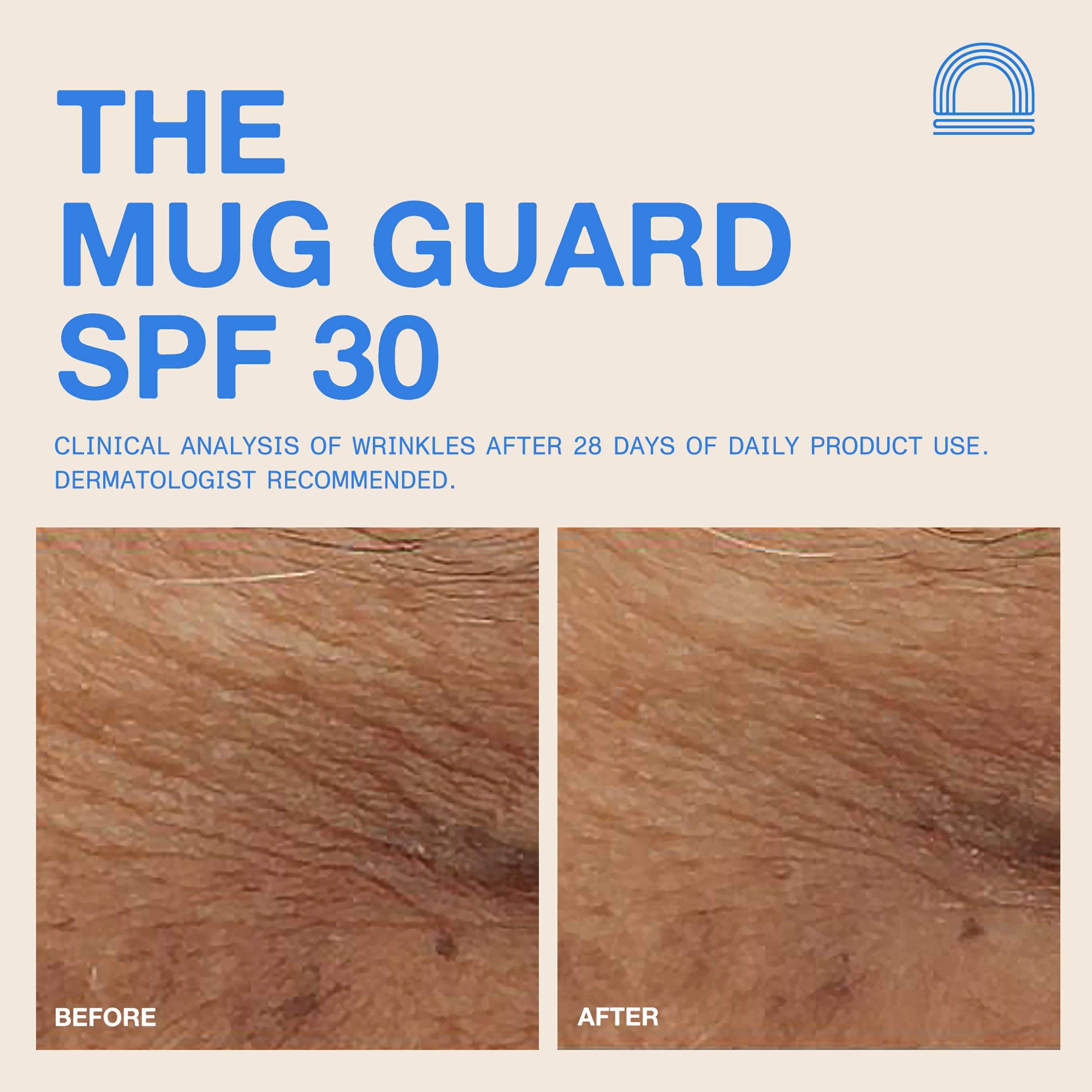 DUNE Suncare- The Mug Guard