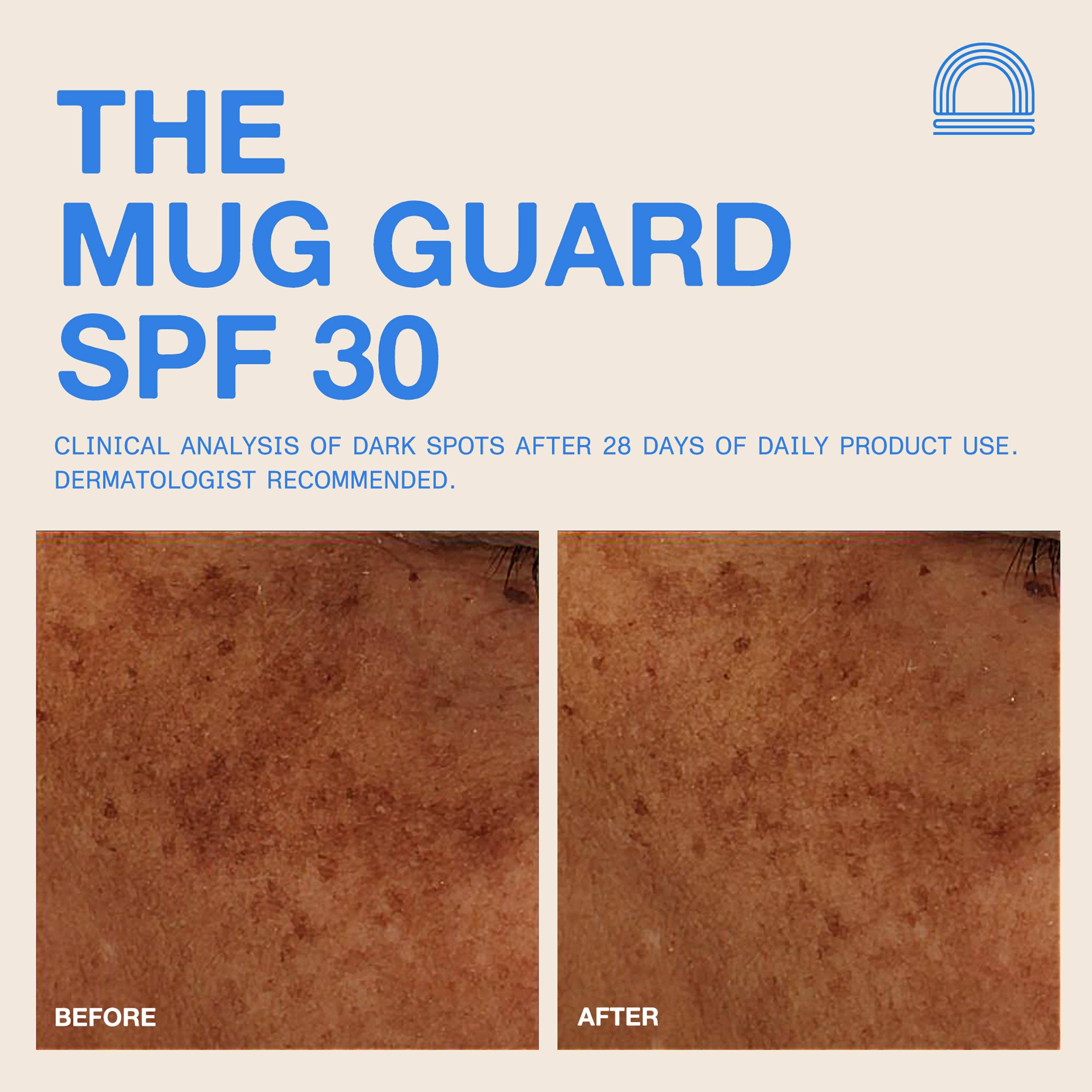 DUNE Suncare- The Mug Guard